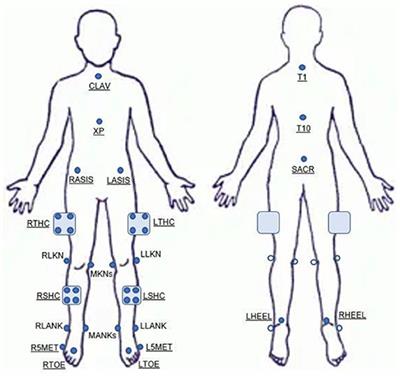 Concurrent Validity of Movement Screening Criteria Designed to Identify Injury Risk Factors in Adolescent Female Volleyball Players